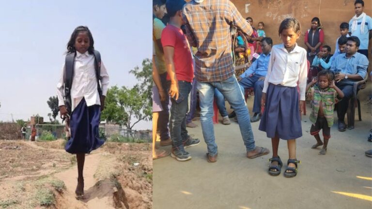 अब दोनों पैरों से चलेगी बिहार की सीमा, प्रशासन ने लगवाया पैर, एक पैर से जाती थी स्कूल