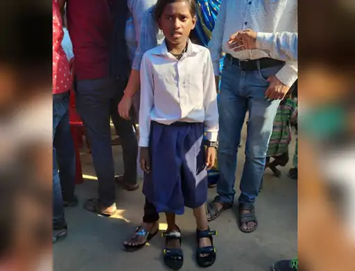Seema of Jamui was fitted with a prosthetic leg